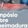 Simpósio sobre prevenção e cuidado de queimaduras acontece na Univap